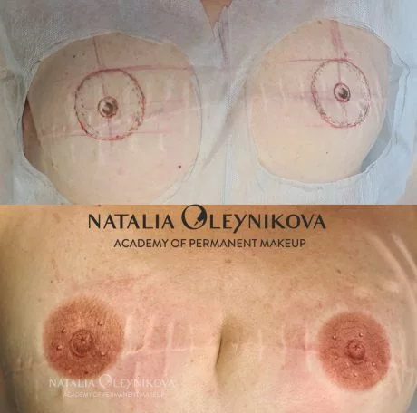 Татуаж ареол