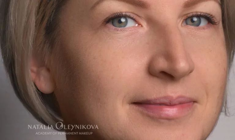 заживший результат