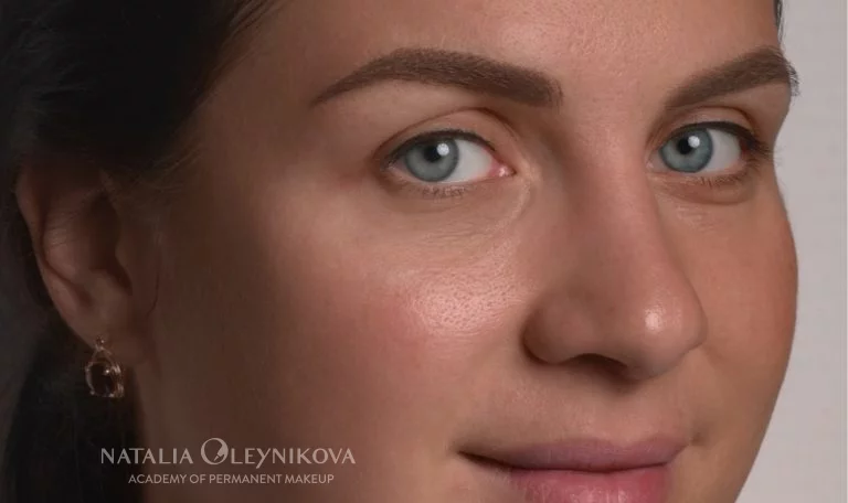 брови после процедуры